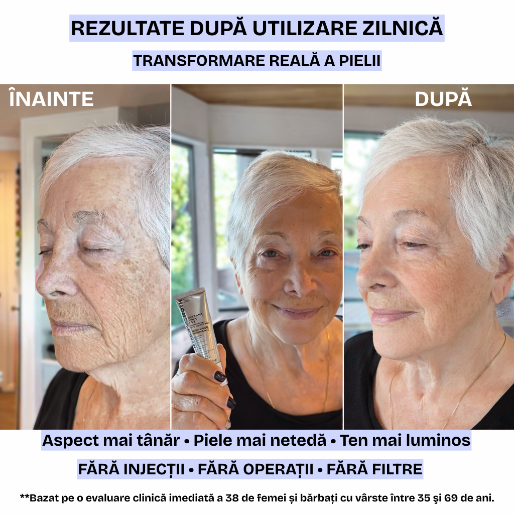 DermaFerm Cearcăne